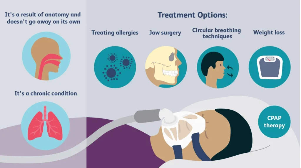 cpap cartoon and diagram of apnea