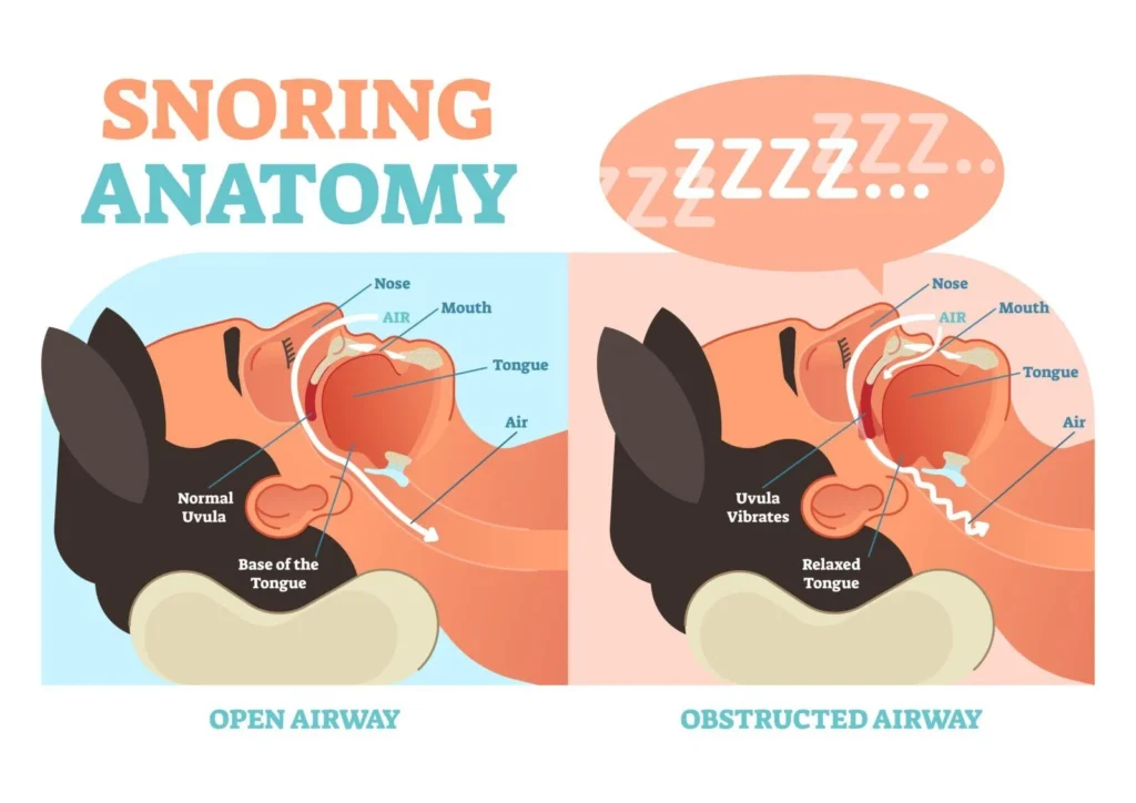 snoring chart